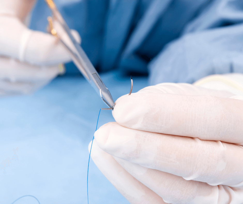 A closeup of a surgeon preparing sutures for surgery.