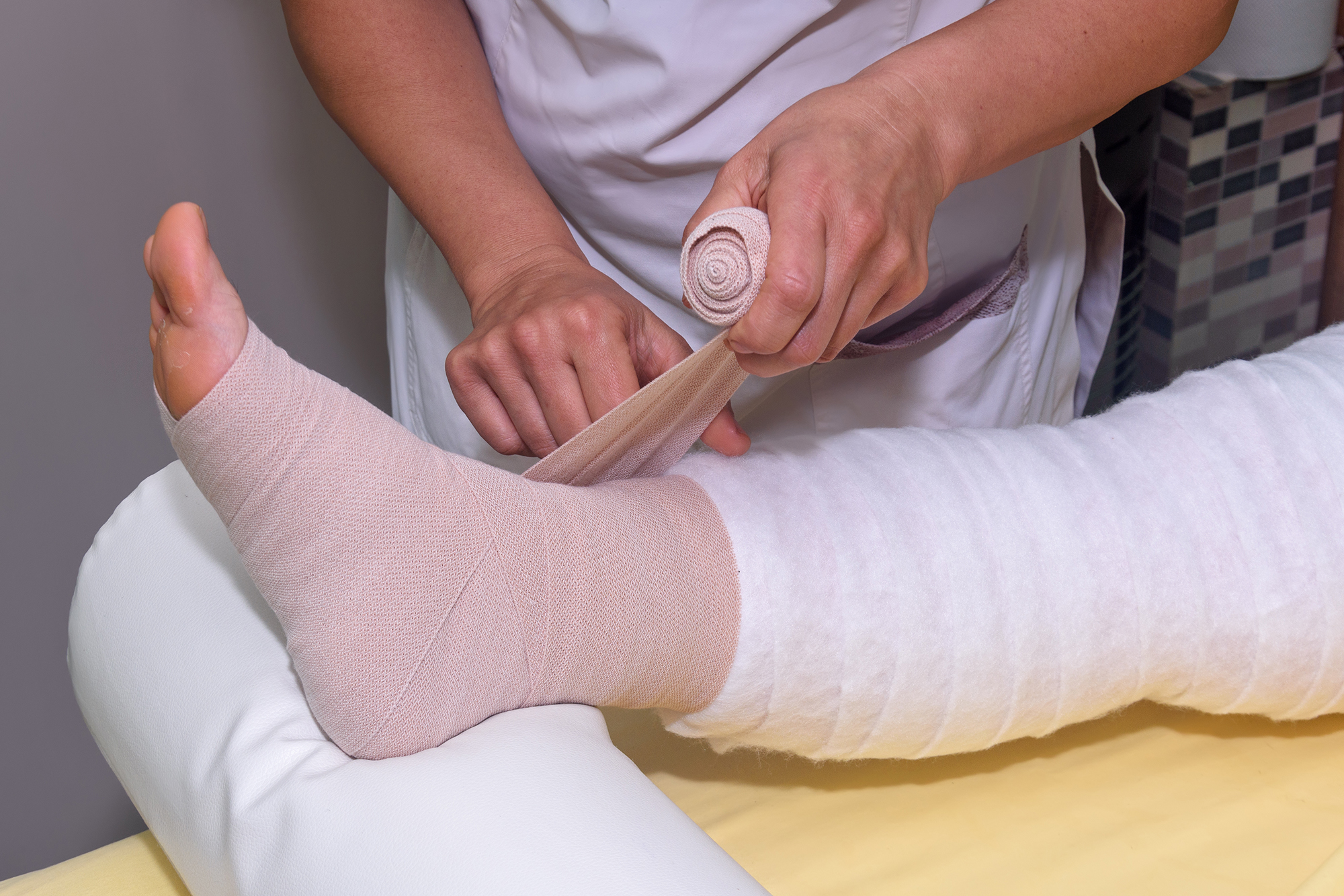 Lymphedema,Management:,Wrapping,Leg,Using,Multilayer,Bandages,To,Control,Lymphedema. multi-layer compression systems for lymphedema