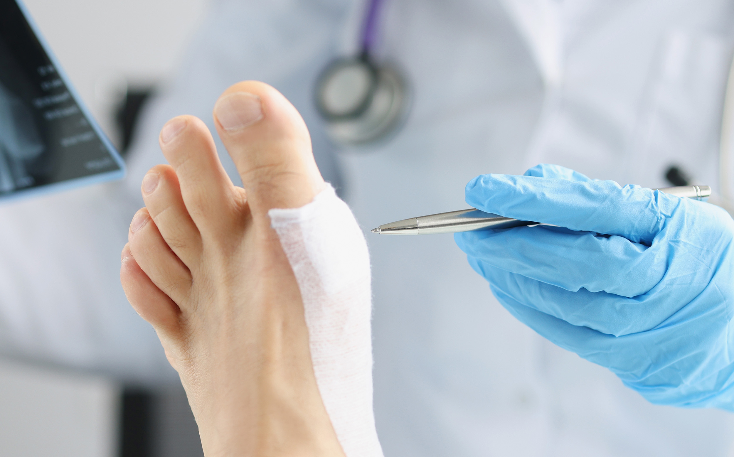 Doctor,Examines,X-ray,Of,Dislocated,Leg,Of,Patient,Lies,On Placental Allograft